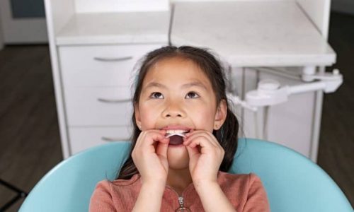 Invisalign-Palatal-Expander-System-by-Align-Technology-Now-Available-in-Australia-and-New-Zealand-for-Skeletal-and-Dental-Expansion-in-Growing-Patients-768x512-1