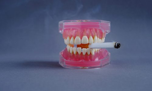 smoking effects on teeth, gums dental health